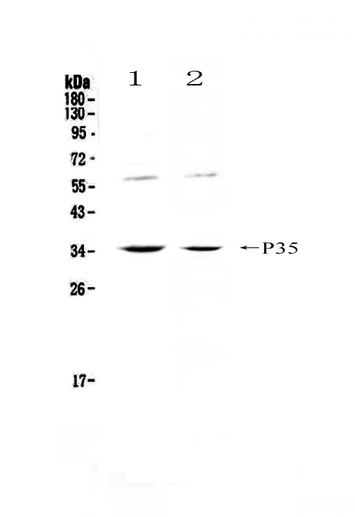  Western blot analysis of IL12A using anti-IL12A antibody (A00918-1)