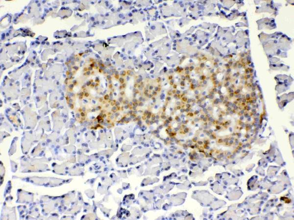 IHC analysis of IGFBP1 using anti-IGFBP1 antibody (A00922-1). IGFBP1 was detected in paraffin-embedded section of rat pancreas tissue. Heat mediated antigen retrieval was performed in citrate buffer (pH6, epitope retrieval solution) for 20 mins. The tissue section was blocked with 10% goat serum. The tissue section was then incubated with 1ug/ml rabbit anti-IGFBP1 Antibody (A00922-1) overnight at 4 Biotinylated goat anti-rabbit IgG was used as secondary antibody and incubated for 30 minutes at 37 The tissue section was developed using Strepavidin-Biotin-Complex (SABC)(Catalog # SA1022) with DAB as the chromogen.