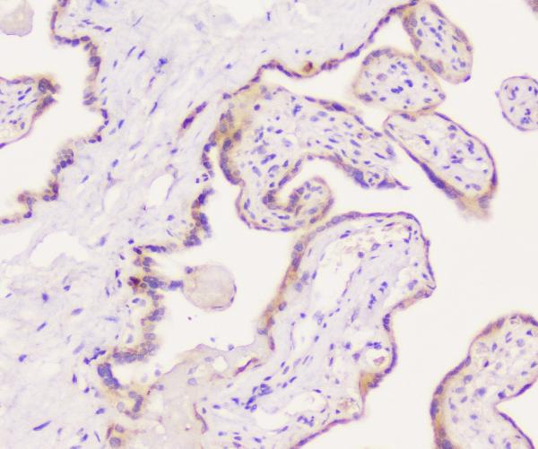 IHC analysis of EML4 using anti-EML4 antibody (A00930-1). EML4 was detected in paraffin-embedded section of human placenta tissue. Heat mediated antigen retrieval was performed in citrate buffer (pH6, epitope retrieval solution) for 20 mins. The tissue section was blocked with 10% goat serum. The tissue section was then incubated with 1μg/ml rabbit anti-EML4 Antibody (A00930-1) overnight at 4°C. Biotinylated goat anti-rabbit IgG was used as secondary antibody and incubated for 30 minutes at 37°C. The tissue section was developed using Strepavidin-Biotin-Complex (SABC)(Catalog # SA1022) with DAB as the chromogen.