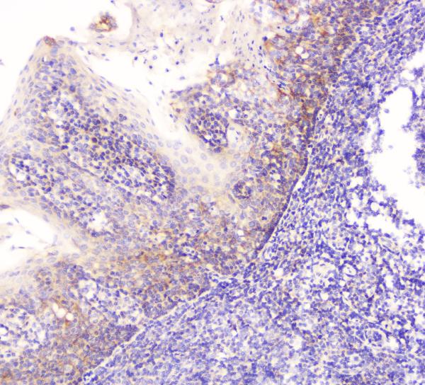 IHC analysis of EML4 using anti-EML4 antibody (A00930-1). EML4 was detected in paraffin-embedded section of human tonsil tissue. Heat mediated antigen retrieval was performed in citrate buffer (pH6, epitope retrieval solution) for 20 mins. The tissue section was blocked with 10% goat serum. The tissue section was then incubated with 1μg/ml rabbit anti-EML4 Antibody (A00930-1) overnight at 4°C. Biotinylated goat anti-rabbit IgG was used as secondary antibody and incubated for 30 minutes at 37°C. The tissue section was developed using Strepavidin-Biotin-Complex (SABC)(Catalog # SA1022) with DAB as the chromogen.