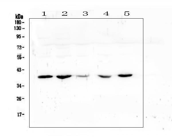  Western blot analysis of uPA Receptor using anti-uPA Receptor antibody (A00993-3)