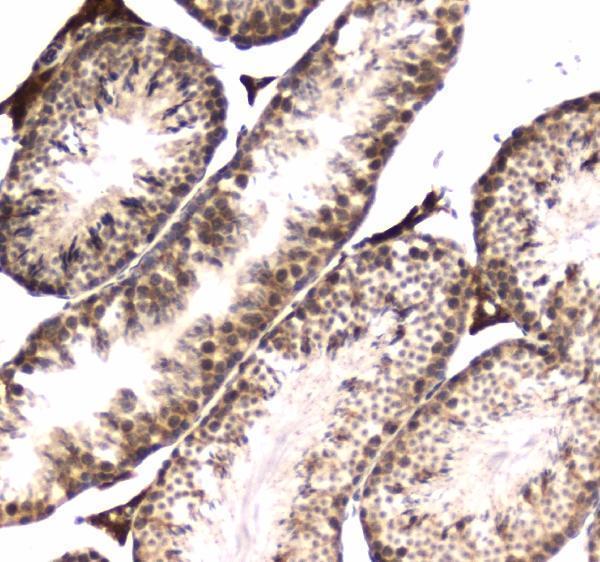  IHC analysis of POLR2A using anti-POLR2A antibody (A01029)