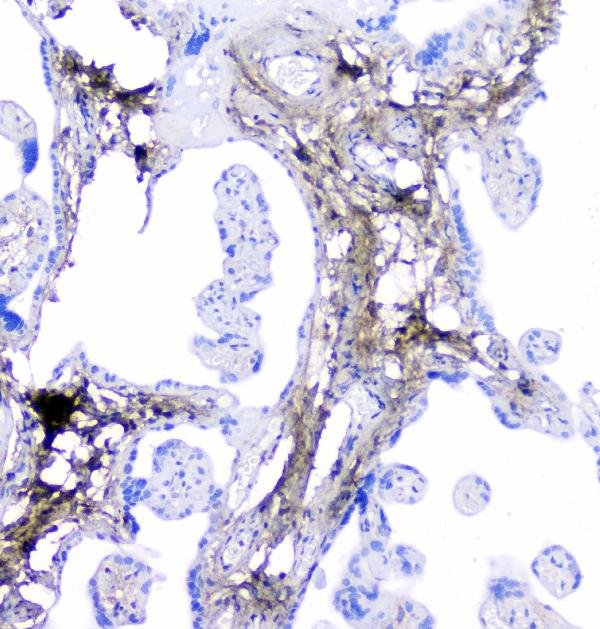 IHC analysis of Lumican using anti-Lumican antibody (A01034-1). Lumican was detected in paraffin-embedded section of human placenta tissue. Heat mediated antigen retrieval was performed in citrate buffer (pH6, epitope retrieval solution) for 20 mins. The tissue section was blocked with 10% goat serum. The tissue section was then incubated with 1μg/ml rabbit anti-Lumican Antibody (A01034-1) overnight at 4°C. Biotinylated goat anti-rabbit IgG was used as secondary antibody and incubated for 30 minutes at 37°C. The tissue section was developed using Strepavidin-Biotin-Complex (SABC)(Catalog # SA1022) with DAB as the chromogen.