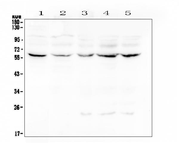Western blot analysis of Lumican using anti-Lumican antibody (A01034-1). Electrophoresis was performed on a 5-20% SDS-PAGE gel at 70V (Stacking gel) / 90V (Resolving gel) for 2-3 hours. The sample well of each lane was loaded with 50ug of sample under reducing conditions. Lane 1: human placenta tissue lysates, Lane 2: human Caco-2 whole cell lysate, Lane 3: human CCRF-CEM whole cell lysate, Lane 4: human Hela whole cell lysate, Lane 5: human Jurkat whole cell lysate. After Electrophoresis, proteins were transferred to a Nitrocellulose membrane at 150mA for 50-90 minutes. Blocked the membrane with 5% Non-fat Milk/ TBS for 1.5 hour at RT. The membrane was incubated with rabbit anti-Lumican antigen affinity purified polyclonal antibody (Catalog # A01034-1) at 0.5 μg/mL overnight at 4°C, then washed with TBS-0.1%Tween 3 times with 5 minutes each and probed with a goat anti-rabbit IgG-HRP secondary antibody at a dilution of 1:10000 for 1.5 hour at RT. The signal is developed using an Enhanced Chemiluminescent detection (ECL) kit (Catalog # EK1002) with Tanon 5200 system. A specific band was detected for Lumican at approximately 58KD. The expected band size for Lumican is at 38KD.