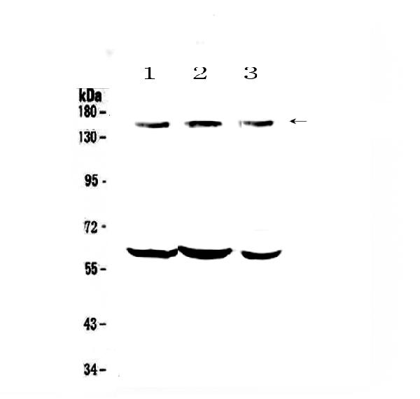 Western blot analysis of KCNH1 using anti-KCNH1 antibody (A01036-2).