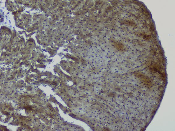 IHC analysis of NRF1 using anti-NRF1 antibody (A01129-2). NRF1 was detected in paraffin-embedded section of rat heart tissue. Heat mediated antigen retrieval was performed in citrate buffer (pH6, epitope retrieval solution) for 20 mins. The tissue section was blocked with 10% goat serum. The tissue section was then incubated with 1μg/ml rabbit anti-NRF1 Antibody (A01129-2) overnight at 4°C. Biotinylated goat anti-rabbit IgG was used as secondary antibody and incubated for 30 minutes at 37°C. The tissue section was developed using Strepavidin-Biotin-Complex (SABC)(Catalog # SA1022) with DAB as the chromogen.