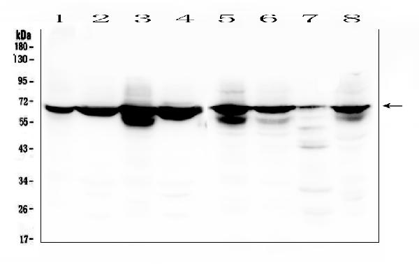 Figure 1. Western blot analysis of LBR using anti-LBR antibody (A01238-2). Electrophoresis was performed on a 5-20% SDS-PAGE gel at 70V (Stacking gel) / 90V (Resolving gel) for 2-3 hours. The sample well of each lane was loaded with 50ug of sample under reducing conditions. Lane 1: human placenta tissue lysates Lane 2: human HL-60 whole cell lysates Lane 3: human K562 whole cell lysates Lane 4: human THP-1 whole cell lysates Lane 5: human HEK293 whole cell lysates Lane 6: human U2OS whole cell lysates Lane 7: human U-937 whole cell lysates Lane 8: human Caco-2 whole cell lysates After Electrophoresis, proteins were transferred to a Nitrocellulose membrane at 150mA for 50-90 minutes. Blocked the membrane with 5% Non-fat Milk/ TBS for 1.5 hour at RT. The membrane was incubated with rabbit anti-LBR antigen affinity purified polyclonal antibody (Catalog # A01238-2) at 0.5 microg/mL overnight at 4°C, then washed with TBS-0.1%Tween 3 times with 5 minutes each and probed with a goat anti-rabbit IgG-HRP secondary antibody at a dilution of 1:10000 for 1.5 hour at RT. The signal is developed using an Enhanced Chemiluminescent detection (ECL) kit (Catalog # EK1002) with Tanon 5200 system. A specific band was detected for LBR at approximately 65-71KD. The expected band size for LBR is at 71KD.