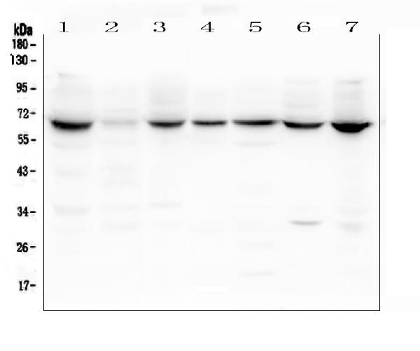 Figure 2. Western blot analysis of LBR using anti-LBR antibody (A01238-2). Electrophoresis was performed on a 5-20% SDS-PAGE gel at 70V (Stacking gel) / 90V (Resolving gel) for 2-3 hours. The sample well of each lane was loaded with 50ug of sample under reducing conditions. Lane 1: rat thymus tissue lysates Lane 2: rat spleen tissue lysates Lane 3: rat testicular tissue lysates Lane 4: mouse thymus tissue lysates Lane 5: mouse stomach tissue lysates Lane 6: mouse testicular tissue lysates Lane 7: mouse SP20 whole cell lysates After Electrophoresis, proteins were transferred to a Nitrocellulose membrane at 150mA for 50-90 minutes. Blocked the membrane with 5% Non-fat Milk/ TBS for 1.5 hour at RT. The membrane was incubated with rabbit anti-LBR antigen affinity purified polyclonal antibody (Catalog # A01238-2) at 0.5 microg/mL overnight at 4°C, then washed with TBS-0.1%Tween 3 times with 5 minutes each and probed with a goat anti-rabbit IgG-HRP secondary antibody at a dilution of 1:10000 for 1.5 hour at RT. The signal is developed using an Enhanced Chemiluminescent detection (ECL) kit (Catalog # EK1002) with Tanon 5200 system. A specific band was detected for LBR at approximately 65-71KD. The expected band size for LBR is at 71KD. Figure 2. Western blot analysis of LBR using anti-LBR antibody (A01238-2). Electrophoresis was performed on a 5-20% SDS-PAGE gel at 70V (Stacking gel) / 90V (Resolving gel) for 2-3 hours. The sample well of each lane was loaded with 50ug of sample under reducing conditions. Lane 1: rat thymus tissue lysates Lane 2: rat spleen tissue lysates Lane 3: rat testicular tissue lysates Lane 4: mouse thymus tissue lysates Lane 5: mouse stomach tissue lysates Lane 6: mouse testicular tissue lysates Lane 7: mouse SP20 whole cell lysates After Electrophoresis, proteins were transferred to a Nitrocellulose membrane at 150mA for 50-90 minutes. Blocked the membrane with 5% Non-fat Milk/ TBS for 1.5 hour at RT. The membrane was incubated with rabbit anti-LBR antigen affinity purified polyclonal antibody (Catalog # A01238-2) at 0.5 microg/mL overnight at 4°C, then washed with TBS-0.1%Tween 3 times with 5 minutes each and probed with a goat anti-rabbit IgG-HRP secondary antibody at a dilution of 1:10000 for 1.5 hour at RT. The signal is developed using an Enhanced Chemiluminescent detection (ECL) kit (Catalog # EK1002) with Tanon 5200 system. A specific band was detected for LBR at approximately 65-71KD. The expected band size for LBR is at 71KD.