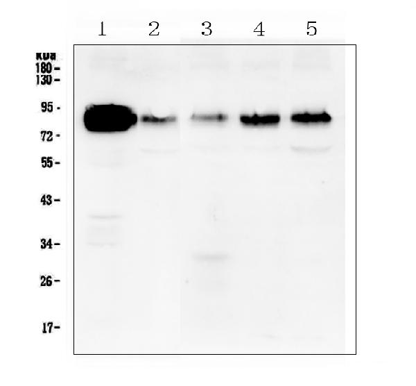 Western blot analysis of cortactin using anti-cortactin antibody (A01253-1). Electrophoresis was performed on a 5-20% SDS-PAGE gel at 70V (Stacking gel) / 90V (Resolving gel) for 2-3 hours. The sample well of each lane was loaded with 50ug of sample under reducing conditions. Lane 1: human A431 whole cell lysate, Lane 2: human U-87MG whole cell lysate, Lane 3: human A549 whole cell lysate, Lane 4: human PC-3 whole cell lysate, Lane 5: human Hela whole cell lysate. After Electrophoresis, proteins were transferred to a Nitrocellulose membrane at 150mA for 50-90 minutes. Blocked the membrane with 5% Non-fat Milk/ TBS for 1.5 hour at RT. The membrane was incubated with rabbit anti-cortactin antigen affinity purified polyclonal antibody (Catalog # A01253-1) at 0.5 μg/mL overnight at 4°C, then washed with TBS-0.1%Tween 3 times with 5 minutes each and probed with a goat anti-rabbit IgG-HRP secondary antibody at a dilution of 1:10000 for 1.5 hour at RT. The signal is developed using an Enhanced Chemiluminescent detection (ECL) kit (Catalog # EK1002) with Tanon 5200 system. A specific band was detected for cortactin at approximately 85KD. The expected band size for cortactin is at 61KD.