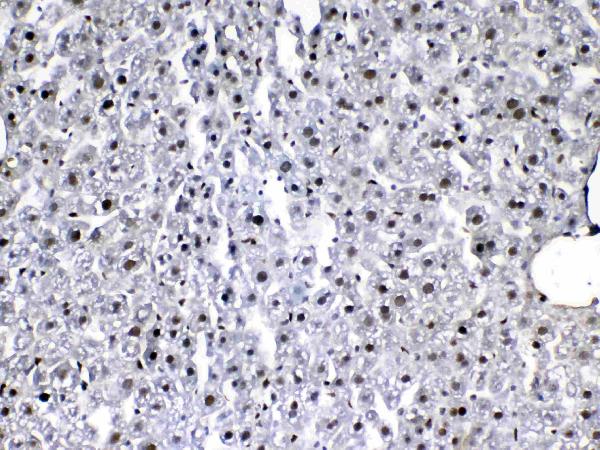 IHC analysis of VEGF Receptor 3 using anti-VEGF Receptor 3 antibody (A01276-2). VEGF Receptor 3 was detected in paraffin-embedded section of mouse liver tissue. Heat mediated antigen retrieval was performed in citrate buffer (pH6, epitope retrieval solution) for 20 mins. The tissue section was blocked with 10% goat serum. The tissue section was then incubated with 1ug/ml rabbit anti-VEGF Receptor 3 Antibody (A01276-2) overnight at 4 Biotinylated goat anti-rabbit IgG was used as secondary antibody and incubated for 30 minutes at 37 The tissue section was developed using Strepavidin-Biotin-Complex (SABC)(Catalog # SA1022) with DAB as the chromogen.