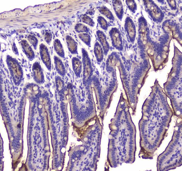 Figure 2. IHC analysis of Cannabinoid Receptor I using anti-Cannabinoid Receptor I antibody (A01291-1). Cannabinoid Receptor I was detected in paraffin-embedded section of mouse small intestine tissue. Heat mediated antigen retrieval was performed in citrate buffer (pH6, epitope retrieval solution) for 20 mins. The tissue section was blocked with 10% goat serum. The tissue section was then incubated with 1microg/ml rabbit anti-Cannabinoid Receptor I Antibody (A01291-1) overnight at 4°C. Biotinylated goat anti-rabbit IgG was used as secondary antibody and incubated for 30 minutes at 37°C. The tissue section was developed using Strepavidin-Biotin-Complex (SABC)(Catalog # SA1022) with DAB as the chromogen.