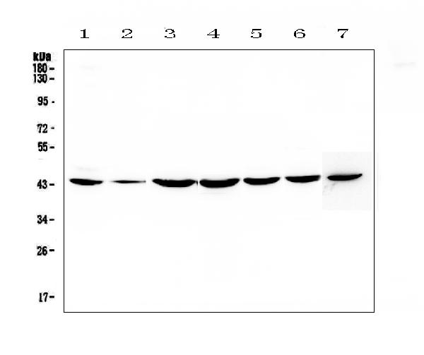 Western blot analysis of FLIP using anti-FLIP antibody (A01295-1). Electrophoresis was performed on a 5-20% SDS-PAGE gel at 70V (Stacking gel) / 90V (Resolving gel) for 2-3 hours. The sample well of each lane was loaded with 50ug of sample under reducing conditions. Lane 1: human Hela whole cell lysates, Lane 2: human placenta tissue lysates, Lane 3: human COLO-320 whole cell lysates, Lane 4: human PANC-1 whole cell lysates, Lane 5: human HepG2 whole cell lysates, Lane 6: human MDA-MB-231 whole cell lysates, Lane 7: mouse NIH3T3 whole cell lysates. After Electrophoresis, proteins were transferred to a Nitrocellulose membrane at 150mA for 50-90 minutes. Blocked the membrane with 5% Non-fat Milk/ TBS for 1.5 hour at RT. The membrane was incubated with rabbit anti-FLIP antigen affinity purified polyclonal antibody (Catalog # A01295-1) at 0.5 μg/mL overnight at 4℃, then washed with TBS-0.1%Tween 3 times with 5 minutes each and probed with a goat anti-rabbit IgG-HRP secondary antibody at a dilution of 1:10000 for 1.5 hour at RT. The signal is developed using an Enhanced Chemiluminescent detection (ECL) kit (Catalog # EK1002) with Tanon 5200 system. A specific band was detected for FLIP at approximately 43KD. The expected band size for FLIP is at 55KD.