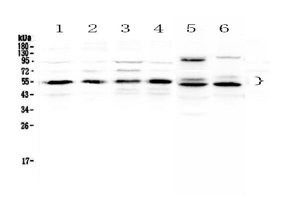 Western blot analysis of RXRA using anti-RXRA antibody (A01299-1).