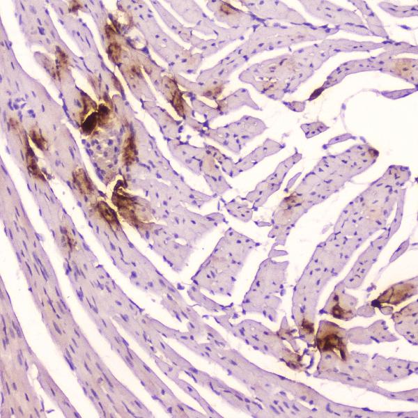 IHC analysis of ANP using anti-ANP antibody (A01318-1). ANP was detected in paraffin-embedded section of mouse cardiac muscle tissue. Heat mediated antigen retrieval was performed in citrate buffer (pH6, epitope retrieval solution) for 20 mins. The tissue section was blocked with 10% goat serum. The tissue section was then incubated with 2μg/ml rabbit anti-ANP Antibody (A01318-1) overnight at 4℃. Biotinylated goat anti-rabbit IgG was used as secondary antibody and incubated for 30 minutes at 37℃. The tissue section was developed using Strepavidin-Biotin-Complex (SABC)(Catalog # SA1022) with DAB as the chromogen.