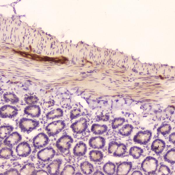 A01318 ANP primary antibodies IHC testing 4_1