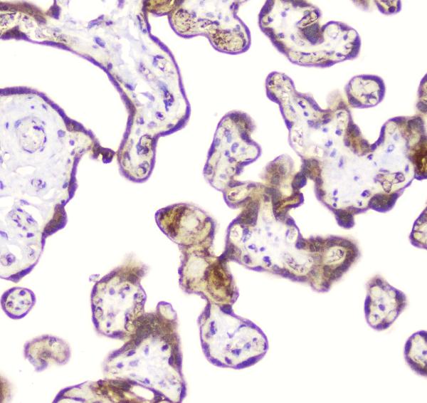 IHC analysis of DDT using anti-DDT antibody (A01354). DDT was detected in paraffin-embedded section of human placenta tissue. Heat mediated antigen retrieval was performed in citrate buffer (pH6, epitope retrieval solution) for 20 mins. The tissue section was blocked with 10% goat serum. The tissue section was then incubated with 2μg/ml rabbit anti-DDT Antibody (A01354) overnight at 4°C. Biotinylated goat anti-rabbit IgG was used as secondary antibody and incubated for 30 minutes at 37°C. The tissue section was developed using Strepavidin-Biotin-Complex (SABC)(Catalog # SA1022) with DAB as the chromogen.