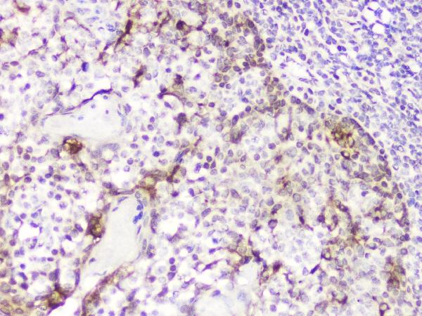 IHC analysis of DDT using anti-DDT antibody (A01354). DDT was detected in paraffin-embedded section of human tonsil tissue. Heat mediated antigen retrieval was performed in citrate buffer (pH6, epitope retrieval solution) for 20 mins. The tissue section was blocked with 10% goat serum. The tissue section was then incubated with 2μg/ml rabbit anti-DDT Antibody (A01354) overnight at 4°C. Biotinylated goat anti-rabbit IgG was used as secondary antibody and incubated for 30 minutes at 37°C. The tissue section was developed using Strepavidin-Biotin-Complex (SABC)(Catalog # SA1022) with DAB as the chromogen.