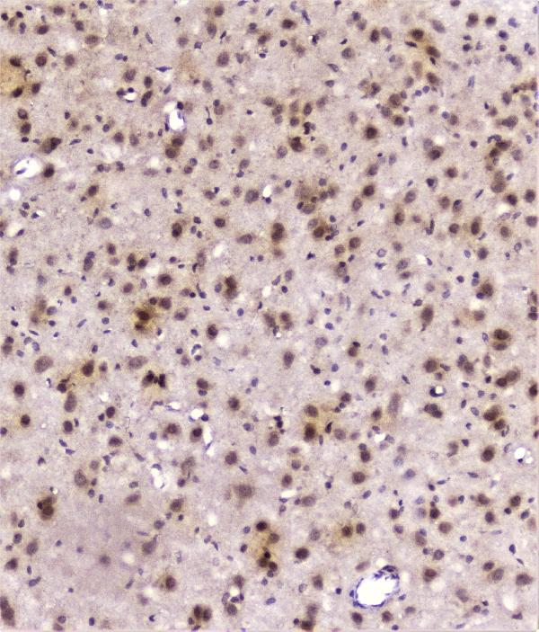 IHC analysis of DDT using anti-DDT antibody (A01354). DDT was detected in paraffin-embedded section of rat brain tissue. Heat mediated antigen retrieval was performed in citrate buffer (pH6, epitope retrieval solution) for 20 mins. The tissue section was blocked with 10% goat serum. The tissue section was then incubated with 2μg/ml rabbit anti-DDT Antibody (A01354) overnight at 4°C. Biotinylated goat anti-rabbit IgG was used as secondary antibody and incubated for 30 minutes at 37°C. The tissue section was developed using Strepavidin-Biotin-Complex (SABC)(Catalog # SA1022) with DAB as the chromogen.