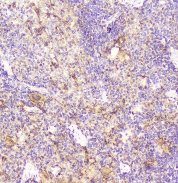 IHC analysis of DDT using anti-DDT antibody (A01354). DDT was detected in paraffin-embedded section of rat spleen tissue. Heat mediated antigen retrieval was performed in citrate buffer (pH6, epitope retrieval solution) for 20 mins. The tissue section was blocked with 10% goat serum. The tissue section was then incubated with 2μg/ml rabbit anti-DDT Antibody (A01354) overnight at 4°C. Biotinylated goat anti-rabbit IgG was used as secondary antibody and incubated for 30 minutes at 37°C. The tissue section was developed using Strepavidin-Biotin-Complex (SABC)(Catalog # SA1022) with DAB as the chromogen.