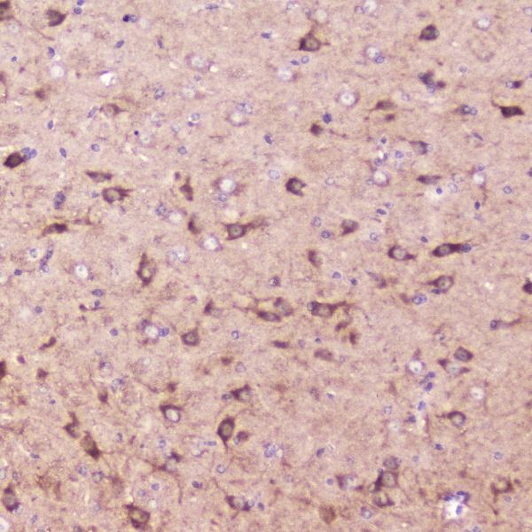 IHC analysis of IGFBP2 using anti-IGFBP2 antibody (A01373-2). IGFBP2 was detected in paraffin-embedded section of mouse brain tissue. Heat mediated antigen retrieval was performed in citrate buffer (pH6, epitope retrieval solution) for 20 mins. The tissue section was blocked with 10% goat serum. The tissue section was then incubated with 2μg/ml rabbit anti-IGFBP2 Antibody (A01373-2) overnight at 4℃. Biotinylated goat anti-rabbit IgG was used as secondary antibody and incubated for 30 minutes at 37℃. The tissue section was developed using Strepavidin-Biotin-Complex (SABC)(Catalog # SA1022) with DAB as the chromogen.