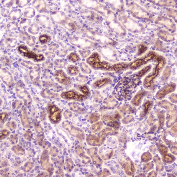 A01373 2 IGFBP2 primary antibodies IHC testing 4_1