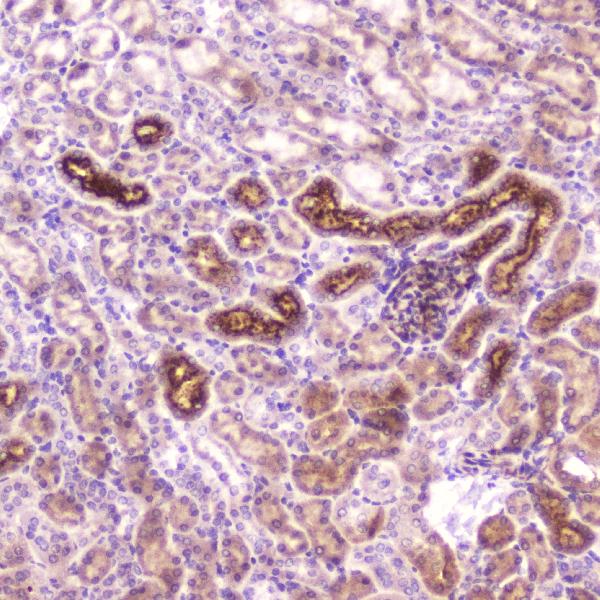 IHC analysis of IGFBP2 using anti-IGFBP2 antibody (A01373-2). IGFBP2 was detected in paraffin-embedded section of mouse kidney tissue. Heat mediated antigen retrieval was performed in citrate buffer (pH6, epitope retrieval solution) for 20 mins. The tissue section was blocked with 10% goat serum. The tissue section was then incubated with 2μg/ml rabbit anti-IGFBP2 Antibody (A01373-2) overnight at 4°C. Biotinylated goat anti-rabbit IgG was used as secondary antibody and incubated for 30 minutes at 37°C. The tissue section was developed using Strepavidin-Biotin-Complex (SABC)(Catalog # SA1022) with DAB as the chromogen.