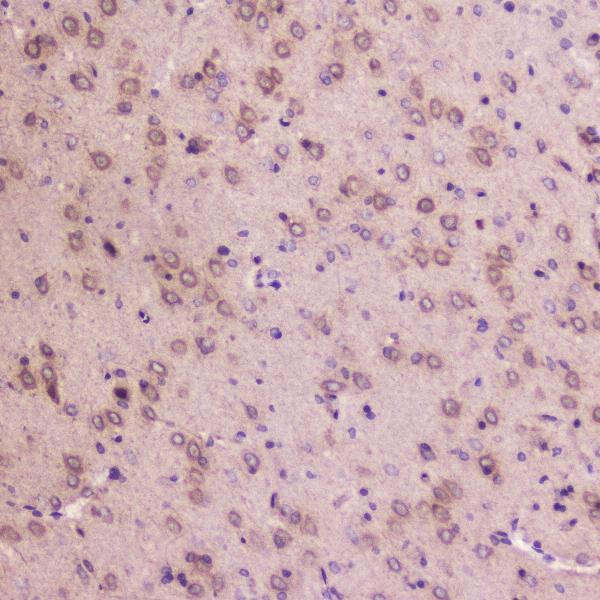 A01373 2 IGFBP2 primary antibodies IHC testing 5_1