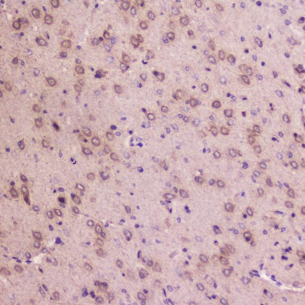IHC analysis of IGFBP2 using anti-IGFBP2 antibody (A01373-2). IGFBP2 was detected in paraffin-embedded section of rat brain tissue. Heat mediated antigen retrieval was performed in citrate buffer (pH6, epitope retrieval solution) for 20 mins. The tissue section was blocked with 10% goat serum. The tissue section was then incubated with 2μg/ml rabbit anti-IGFBP2 Antibody (A01373-2) overnight at 4°C. Biotinylated goat anti-rabbit IgG was used as secondary antibody and incubated for 30 minutes at 37°C. The tissue section was developed using Strepavidin-Biotin-Complex (SABC)(Catalog # SA1022) with DAB as the chromogen.