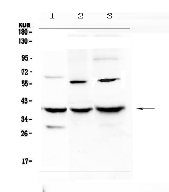 Western blot analysis of IGFBP2 using anti-IGFBP2 antibody (A01373-2). Electrophoresis was performed on a 5-20% SDS-PAGE gel at 70V (Stacking gel) / 90V (Resolving gel) for 2-3 hours. The sample well of each lane was loaded with 50ug of sample under reducing conditions. Lane 1: rat liver tissue lysates, Lane 2: mouse Neuro-2a whole cell lysates, Lane 3: mouse HEPA1-6 whole cell lysates. After Electrophoresis, proteins were transferred to a Nitrocellulose membrane at 150mA for 50-90 minutes. Blocked the membrane with 5% Non-fat Milk/ TBS for 1.5 hour at RT. The membrane was incubated with rabbit anti-IGFBP2 antigen affinity purified polyclonal antibody (Catalog # A01373-2) at 0.5 μg/mL overnight at 4℃, then washed with TBS-0.1%Tween 3 times with 5 minutes each and probed with a goat anti-rabbit IgG-HRP secondary antibody at a dilution of 1:10000 for 1.5 hour at RT. The signal is developed using an Enhanced Chemiluminescent detection (ECL) kit (Catalog # EK1002) with Tanon 5200 system. A specific band was detected for IGFBP2 at approximately 40KD. The expected band size for IGFBP2 is at 35KD.