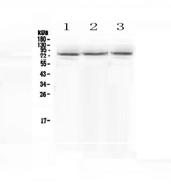 Figure 1. Western blot analysis of SCNN1A using anti-SCNN1A antibody (A01413-1). Electrophoresis was performed on a 5-20% SDS-PAGE gel at 70V (Stacking gel) / 90V (Resolving gel) for 2-3 hours. The sample well of each lane was loaded with 50ug of sample under reducing conditions. Lane 1: human COLO-320 whole cell lysates, Lane 2: human HepG2 whole cell lysates, Lane 3: human A549 whole cell lysates. After Electrophoresis, proteins were transferred to a Nitrocellulose membrane at 150mA for 50-90 minutes. Blocked the membrane with 5% Non-fat Milk/ TBS for 1.5 hour at RT. The membrane was incubated with rabbit anti-SCNN1A antigen affinity purified polyclonal antibody (Catalog # A01413-1) at 0.5 microg/mL overnight at 4°C, then washed with TBS-0.1%Tween 3 times with 5 minutes each and probed with a goat anti-rabbit IgG-HRP secondary antibody at a dilution of 1:10000 for 1.5 hour at RT. The signal is developed using an Enhanced Chemiluminescent detection (ECL) kit (Catalog # EK1002) with Tanon 5200 system. A specific band was detected for SCNN1A at approximately 76KD. The expected band size for SCNN1A is at 76KD.
