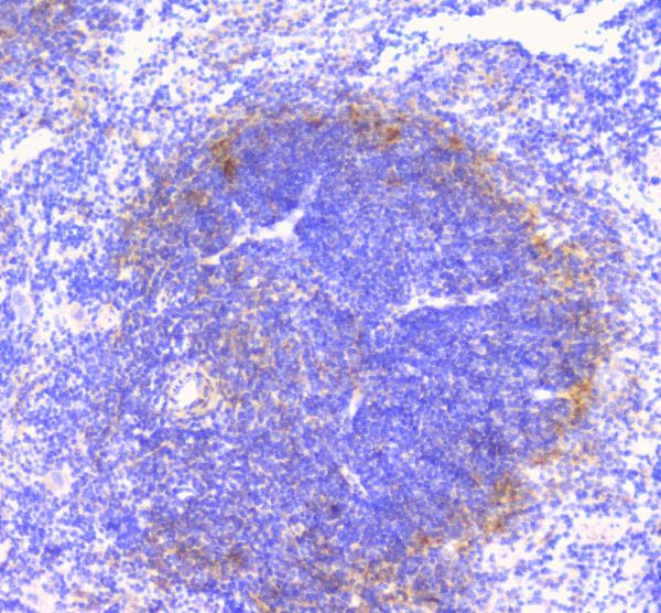 IHC analysis of FCGR2A using anti-FCGR2A antibody (A01450-1). FCGR2A was detected in paraffin-embedded section of mouse spleen tissue. Heat mediated antigen retrieval was performed in citrate buffer (pH6, epitope retrieval solution) for 20 mins. The tissue section was blocked with 10% goat serum. The tissue section was then incubated with 1μg/ml rabbit anti-FCGR2A Antibody (A01450-1) overnight at 4°C. Biotinylated goat anti-rabbit IgG was used as secondary antibody and incubated for 30 minutes at 37°C. The tissue section was developed using Strepavidin-Biotin-Complex (SABC)(Catalog # SA1022) with DAB as the chromogen.
