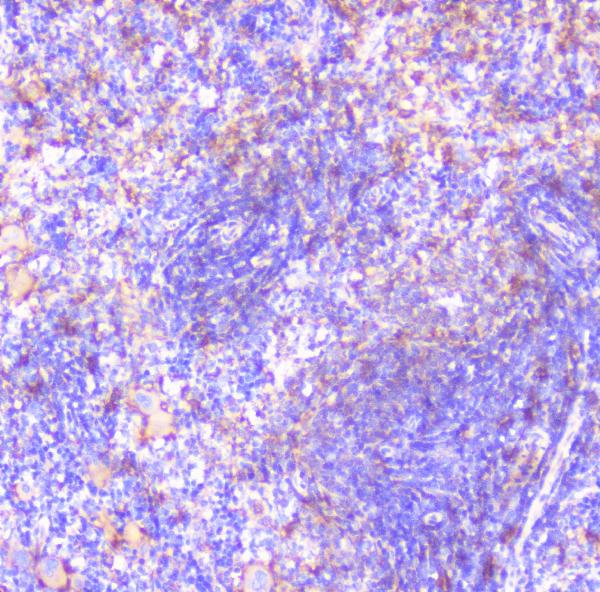 IHC analysis of FCGR2A using anti-FCGR2A antibody (A01450-1). FCGR2A was detected in paraffin-embedded section of rat spleen tissue. Heat mediated antigen retrieval was performed in citrate buffer (pH6, epitope retrieval solution) for 20 mins. The tissue section was blocked with 10% goat serum. The tissue section was then incubated with 1μg/ml rabbit anti-FCGR2A Antibody (A01450-1) overnight at 4°C. Biotinylated goat anti-rabbit IgG was used as secondary antibody and incubated for 30 minutes at 37°C. The tissue section was developed using Strepavidin-Biotin-Complex (SABC)(Catalog # SA1022) with DAB as the chromogen.
