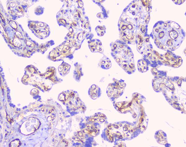 IHC analysis of FCGR2A using anti-FCGR2A antibody (A01450-1). FCGR2A was detected in paraffin-embedded section of human placenta tissue. Heat mediated antigen retrieval was performed in citrate buffer (pH6, epitope retrieval solution) for 20 mins. The tissue section was blocked with 10% goat serum. The tissue section was then incubated with 1μg/ml rabbit anti-FCGR2A Antibody (A01450-1) overnight at 4°C. Biotinylated goat anti-rabbit IgG was used as secondary antibody and incubated for 30 minutes at 37°C. The tissue section was developed using Strepavidin-Biotin-Complex (SABC)(Catalog # SA1022) with DAB as the chromogen.