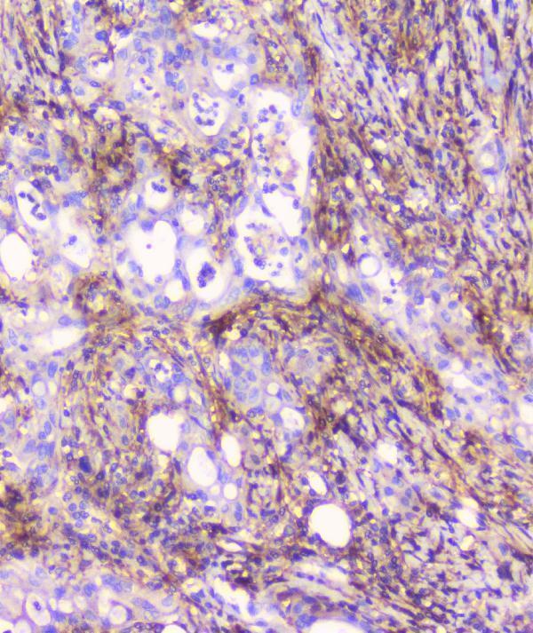 A01450 1 FCGR2A primary antibodies IHC testing 7