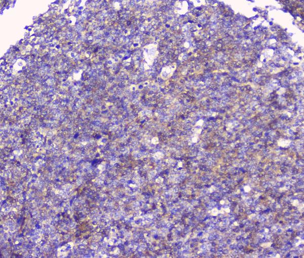 IHC analysis of FCGR2A using anti-FCGR2A antibody (A01450-1). FCGR2A was detected in paraffin-embedded section of human tonsil tissue. Heat mediated antigen retrieval was performed in citrate buffer (pH6, epitope retrieval solution) for 20 mins. The tissue section was blocked with 10% goat serum. The tissue section was then incubated with 1μg/ml rabbit anti-FCGR2A Antibody (A01450-1) overnight at 4°C. Biotinylated goat anti-rabbit IgG was used as secondary antibody and incubated for 30 minutes at 37°C. The tissue section was developed using Strepavidin-Biotin-Complex (SABC)(Catalog # SA1022) with DAB as the chromogen.