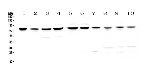 Figure 1. Western blot analysis of PARN using anti-PARN antibody (A01501-2). Electrophoresis was performed on a 5-20% SDS-PAGE gel at 70V (Stacking gel) / 90V (Resolving gel) for 2-3 hours. The sample well of each lane was loaded with 50ug of sample under reducing conditions. Lane 1: human Hela whole cell lysates, Lane 2: human placenta tissue lysates, Lane 3: human COLO-320 whole cell lysates, Lane 4: human HepG2 whole cell lysates, Lane 5: human PANC-1 whole cell lysates, Lane 6: human SGC-7901 whole cell lysates, Lane 7: human MDA-MB-231 whole cell lysates, Lane 8: rat kidney tissue lysates, Lane 9: mouse heart tissue lysates, Lane 10: mouse kidney tissue lysates. After Electrophoresis, proteins were transferred to a Nitrocellulose membrane at 150mA for 50-90 minutes. Blocked the membrane with 5% Non-fat Milk/ TBS for 1.5 hour at RT. The membrane was incubated with rabbit anti-PARN antigen affinity purified polyclonal antibody (Catalog # A01501-2) at 0.5 microg/mL overnight at 4°C, then washed with TBS-0.1%Tween 3 times with 5 minutes each and probed with a goat anti-rabbit IgG-HRP secondary antibody at a dilution of 1:10000 for 1.5 hour at RT. The signal is developed using an Enhanced Chemiluminescent detection (ECL) kit (Catalog # EK1002) with Tanon 5200 system. A specific band was detected for PARN at approximately 78KD. The expected band size for PARN is at 73KD.
