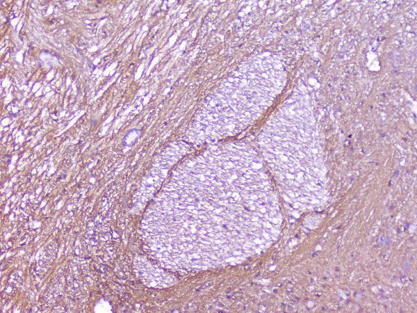 IHC analysis of SNAP25 using anti-SNAP25 antibody (A01625)