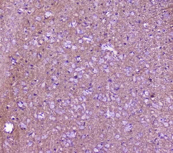 IHC analysis of SNAP25 using anti-SNAP25 antibody (A01625). SNAP25 was detected in paraffin-embedded section of rat brain tissue. Heat mediated antigen retrieval was performed in citrate buffer (pH6, epitope retrieval solution) for 20 mins. The tissue section was blocked with 10% goat serum. The tissue section was then incubated with 2μg/ml rabbit anti-SNAP25 Antibody (A01625) overnight at 4°C. Biotinylated goat anti-rabbit IgG was used as secondary antibody and incubated for 30 minutes at 37°C. The tissue section was developed using Strepavidin-Biotin-Complex (SABC)(Catalog # SA1022) with DAB as the chromogen.