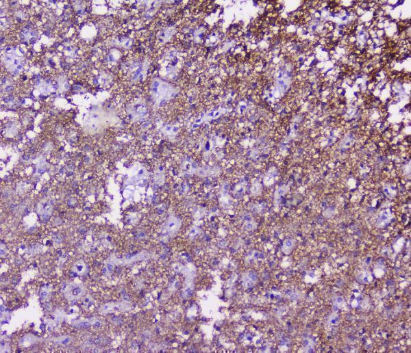 A01625 SNAP25 primary antibodies IHC testing 4