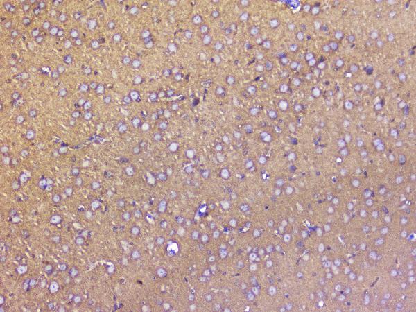 IHC analysis of SNAP25 using anti-SNAP25 antibody (A01625). SNAP25 was detected in paraffin-embedded section of mouse brain tissue. Heat mediated antigen retrieval was performed in citrate buffer (pH6, epitope retrieval solution) for 20 mins. The tissue section was blocked with 10% goat serum. The tissue section was then incubated with 2μg/ml rabbit anti-SNAP25 Antibody (A01625) overnight at 4°C. Biotinylated goat anti-rabbit IgG was used as secondary antibody and incubated for 30 minutes at 37°C. The tissue section was developed using Strepavidin-Biotin-Complex (SABC)(Catalog # SA1022) with DAB as the chromogen.
