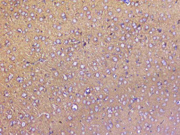 A01625 SNAP25 primary antibodies IHC testing 5
