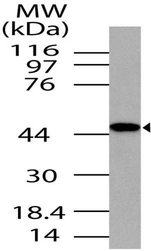 Western blot analysis of TRBP