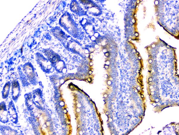 IHC analysis of DDR2 using anti-DDR2 antibody (A01698-1). DDR2 was detected in paraffin-embedded section of rat small intestine tissue. Heat mediated antigen retrieval was performed in citrate buffer (pH6, epitope retrieval solution) for 20 mins. The tissue section was blocked with 10% goat serum. The tissue section was then incubated with 2μg/ml rabbit anti-DDR2 Antibody (A01698-1) overnight at 4°C. Biotinylated goat anti-rabbit IgG was used as secondary antibody and incubated for 30 minutes at 37°C. The tissue section was developed using Strepavidin-Biotin-Complex (SABC)(Catalog # SA1022) with DAB as the chromogen.