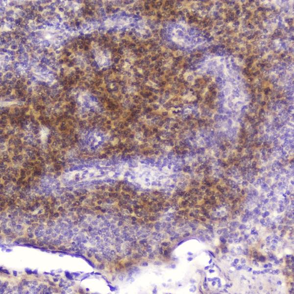 IHC analysis of Cardiac FABP using anti-Cardiac FABP antibody (A01734-1). Cardiac FABP was detected in paraffin-embedded section of human tonsil tissue. Heat mediated antigen retrieval was performed in citrate buffer (pH6, epitope retrieval solution) for 20 mins. The tissue section was blocked with 10% goat serum. The tissue section was then incubated with 2μg/ml rabbit anti-Cardiac FABP Antibody (A01734-1) overnight at 4℃. Biotinylated goat anti-rabbit IgG was used as secondary antibody and incubated for 30 minutes at 37℃. The tissue section was developed using Strepavidin-Biotin-Complex (SABC)(Catalog # SA1022) with DAB as the chromogen.