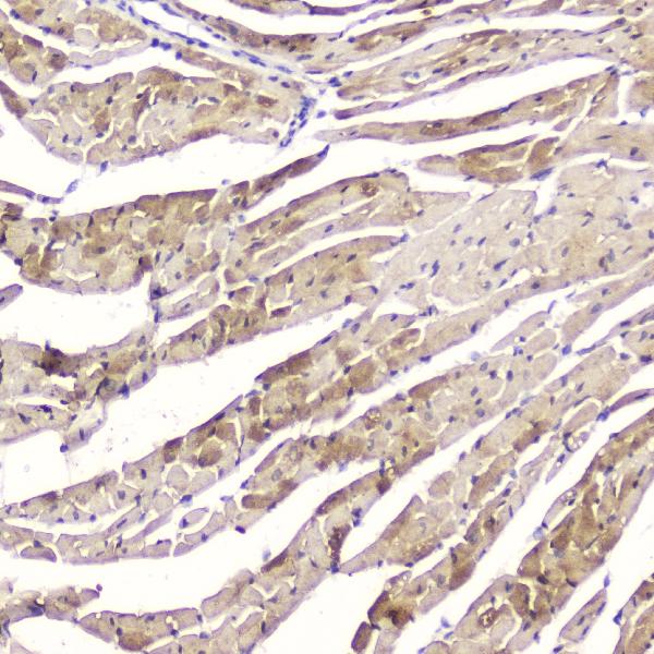 IHC analysis of Cardiac FABP using anti-Cardiac FABP antibody (A01734-1). Cardiac FABP was detected in paraffin-embedded section of mouse heart tissue. Heat mediated antigen retrieval was performed in citrate buffer (pH6, epitope retrieval solution) for 20 mins. The tissue section was blocked with 10% goat serum. The tissue section was then incubated with 2μg/ml rabbit anti-Cardiac FABP Antibody (A01734-1) overnight at 4°C. Biotinylated goat anti-rabbit IgG was used as secondary antibody and incubated for 30 minutes at 37°C. The tissue section was developed using Strepavidin-Biotin-Complex (SABC)(Catalog # SA1022) with DAB as the chromogen.