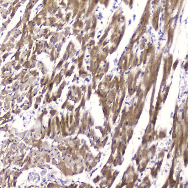 IHC analysis of Cardiac FABP using anti-Cardiac FABP antibody (A01734-1). Cardiac FABP was detected in paraffin-embedded section of rat heart tissue. Heat mediated antigen retrieval was performed in citrate buffer (pH6, epitope retrieval solution) for 20 mins. The tissue section was blocked with 10% goat serum. The tissue section was then incubated with 2μg/ml rabbit anti-Cardiac FABP Antibody (A01734-1) overnight at 4°C. Biotinylated goat anti-rabbit IgG was used as secondary antibody and incubated for 30 minutes at 37°C. The tissue section was developed using Strepavidin-Biotin-Complex (SABC)(Catalog # SA1022) with DAB as the chromogen.