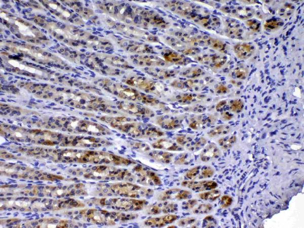 IHC analysis of TFF3 using anti-TFF3 antibody (A01738-2). TFF3 was detected in paraffin-embedded section of rat gaster tissue. Heat mediated antigen retrieval was performed in citrate buffer (pH6, epitope retrieval solution) for 20 mins. The tissue section was blocked with 10% goat serum. The tissue section was then incubated with 1ug/ml rabbit anti-TFF3 Antibody (A01738-2) overnight at 4°C. Biotinylated goat anti-rabbit IgG was used as secondary antibody and incubated for 30 minutes at 37°C. The tissue section was developed using Strepavidin-Biotin-Complex (SABC)(Catalog # SA1022) with DAB as the chromogen.
