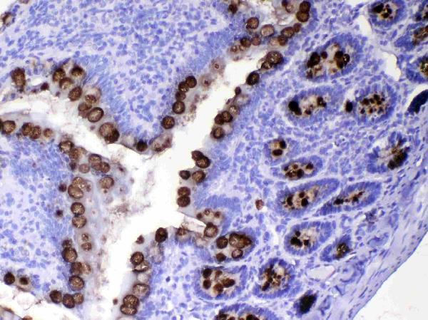 A01738 2 TFF3 primary antibodies IHC testing 5