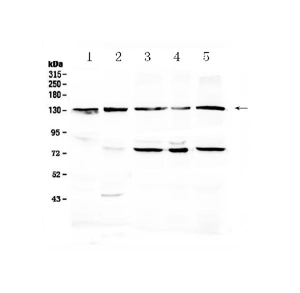 Western blot analysis of PROM1 using anti-PROM1 antibody (A01767).