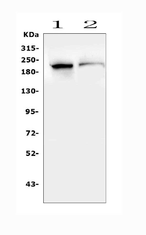 Figure 3. Western blot analysis of SMARCA2 using anti-SMARCA2 antibody (A01888-2). Electrophoresis was performed on a 5-20% SDS-PAGE gel at 70V (Stacking gel) / 90V (Resolving gel) for 2-3 hours. The sample well of each lane was loaded with 50ug of sample under reducing conditions. Lane 1: rat testicular issue lysates, Lane 2: mouse testicula issue lysates. After Electrophoresis, proteins were transferred to a Nitrocellulose membrane at 150mA for 50-90 minutes. Blocked the membrane with 5% Non-fat Milk/ TBS for 1.5 hour at RT. The membrane was incubated with rabbit anti-SMARCA2 antigen affinity purified polyclonal antibody (Catalog # A01888-2) at 0.5 microg/mL overnight at 4°C, then washed with TBS-0.1%Tween 3 times with 5 minutes each and probed with a goat anti-rabbit IgG-HRP secondary antibody at a dilution of 1:10000 for 1.5 hour at RT. The signal is developed using an Enhanced Chemiluminescent detection (ECL) kit (Catalog # EK1002) with Tanon 5200 system. A specific band was detected for SMARCA2 at approximately 210KD. The expected band size for SMARCA2 is at 181KD.